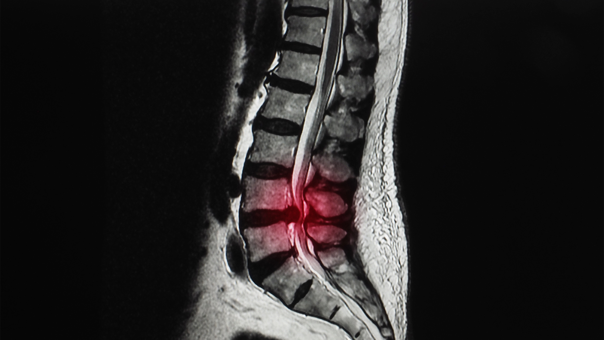 Mening kokrak yoğrulmaktadır